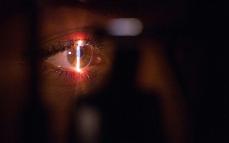 Auge eines Menschen bei augenärztlicher Untersuchung mit Spaltlampe.